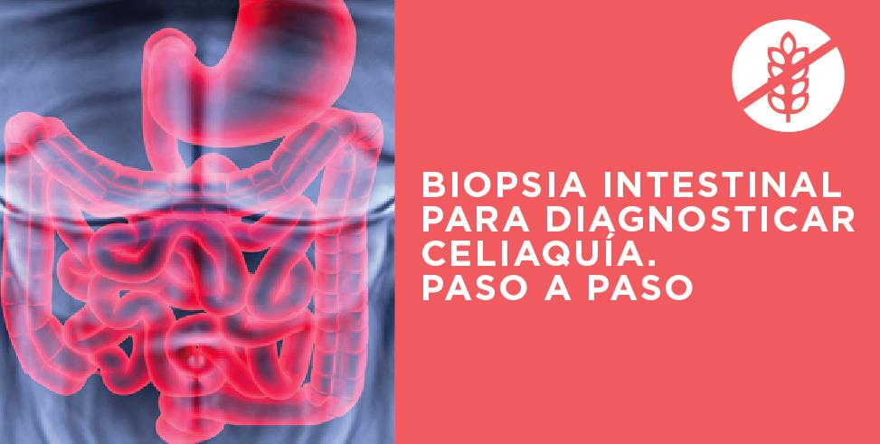 Biopsia intestinal para diagnosticar celiaquía: paso a paso